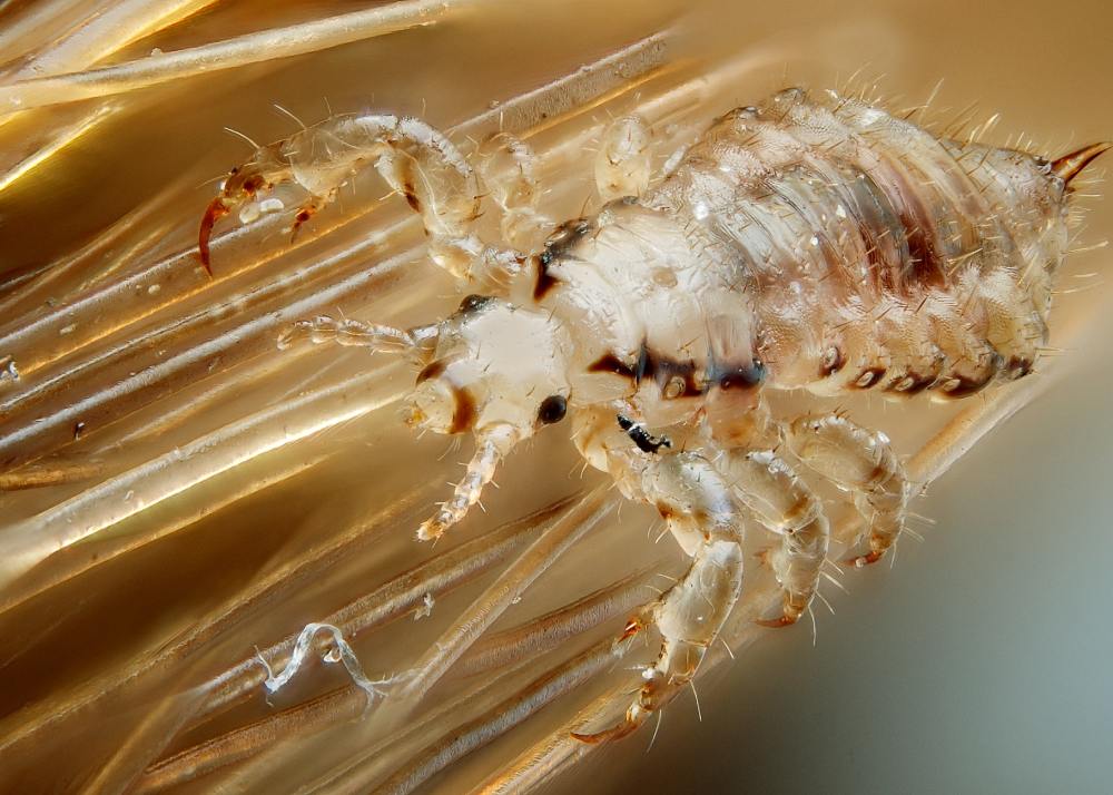 What Are Lice?