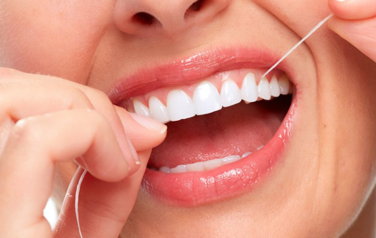 Advance Guide to Floss With Permanent Retainers, Read Now